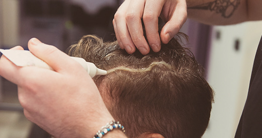 Percorso Rigenerazione Cute e Capelli