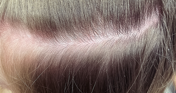 Chapeau I Parrucchieri | Dettaglio dopo il trattamento