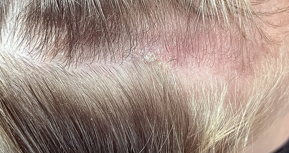 Chapeau I Parrucchieri | Dettaglio prima del trattamento