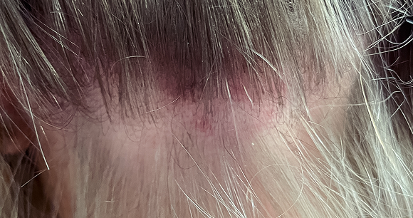 Chapeau I Parrucchieri | Dettaglio dopo il trattamento