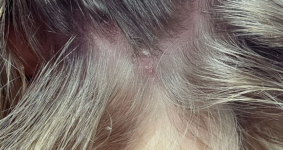 Chapeau I Parrucchieri | Dettaglio prima del trattamento