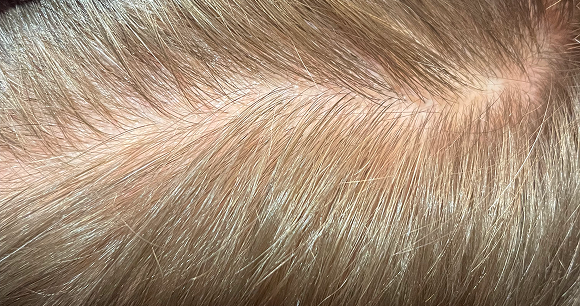 Chapeau I Parrucchieri | Dettaglio dopo il trattamento