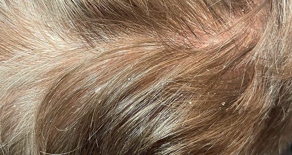 Chapeau I Parrucchieri | Dettaglio prima del trattamento