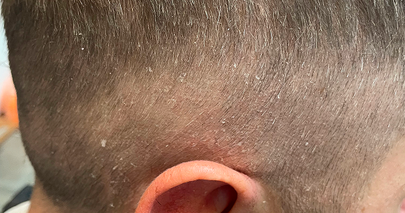 Chapeau I Parrucchieri | Dettaglio prima del trattamento