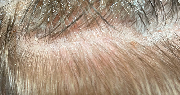 Chapeau I Parrucchieri | Dettaglio dopo il trattamento